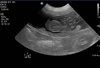 Echographie imagerie - C son vet