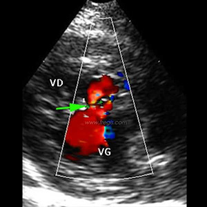 Echocardiographie d’une CIV chat