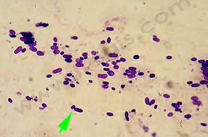 Vue au microscope de la levure