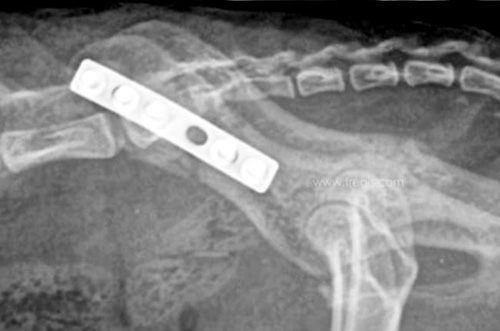 Radiographie de face et de profil d’un chat ayant des fractures du bassin. La chirurgie a permis une stabilisation grâce à une plaque et des vis.