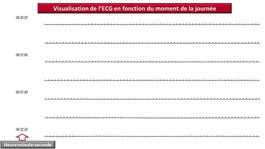 Résultat chez le chat d’un Holter montrant l’ECG en fonction du temps