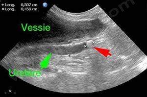 3. Echographie de l’abdomen d’un chat souffrant de calculs urinaires