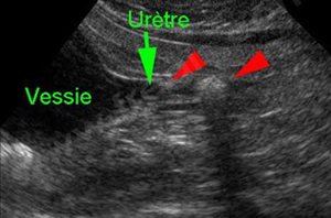 2. Echographie de l’abdomen d’un chat souffrant de calculs urinaires empêchant l’animal d’uriner.