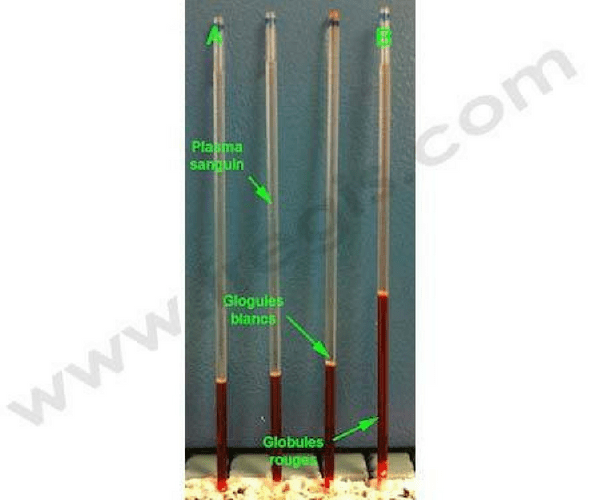 Hématocrite chez le chien. Hémodilution (A) et hémoconcentration (B) du sang. (© Laboratoire VEBIO)