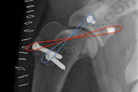 Radiographie post-opératoire du même animal