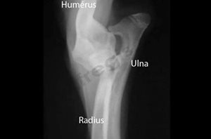 Chien de race Yorkshire terrier présentant une luxation congénitale du coude de type 2. Radiographie de face du coude. C’est une forme moins grave que le type