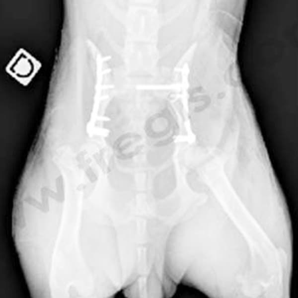 Radiographie post-op: bassi vue du dessus