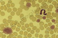 Thrombocytes