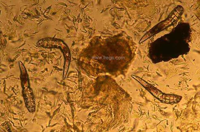 Demodex vus au microscope