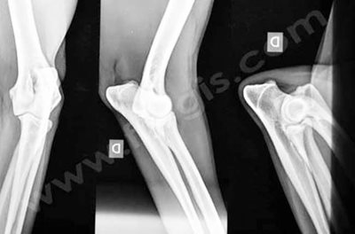 Radiographies de dépistage de la dysplasie du coude du chien