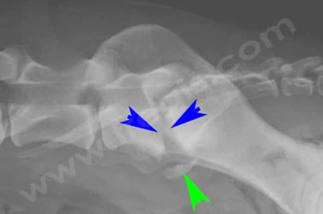 Radiographie de profil de la région lombo-sacrée