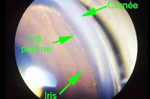 2. Œil normal de chien : examen de l’angle iridocornéen au travers d’une lentille de gonioscopie. La structure visible de l’angle est le ligament pectiné, normalement ouvert dans ce cas.​