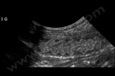 Echographie abdominale d’un chien atteint d’entérite lymphoplasmocytaire montrant un aspect « festonné » de la paroi de l’intestin