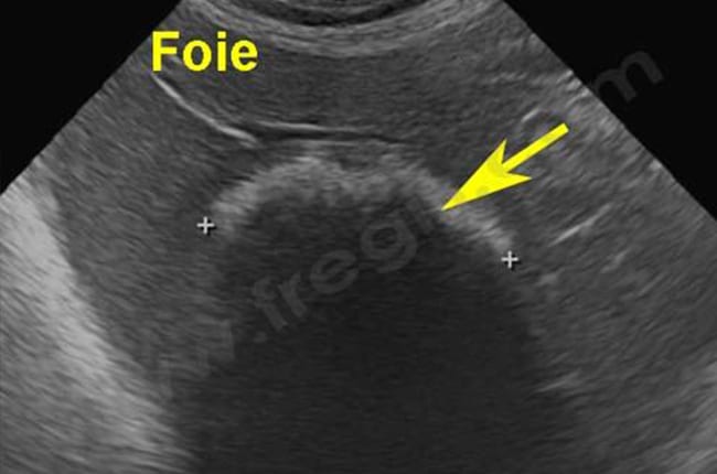 Echographie du foie chez un chien atteint d’un ostéosarcome extra-squelettique.