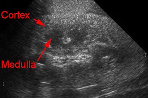 Echographie d’un chien souffrant d’hématurie rénale