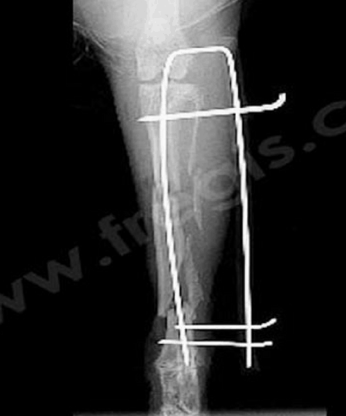 Montage-orthopedique-sur-une-fracture-multiple-sur-un-Lapin - CHV Fregis