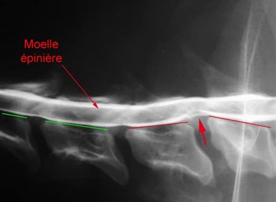 Myélographie sur un chien atteint d’un syndrome de wobbler.