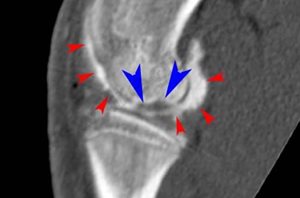 1. Arthroscanner du genou d’un chien American Staffordshire Terrier de 6 mois présenté pour boiterie