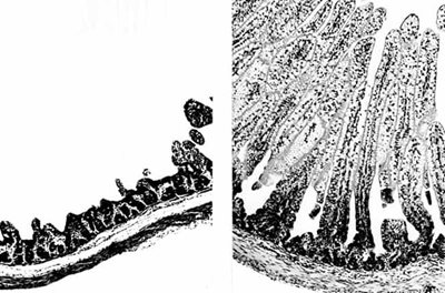 Panleucopénie (typhus) du chat. Grave atrophie de l'épithélium digestif (à gauche). A droite, image normale. (©Katrin Hartmann)