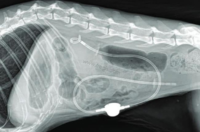 Radiographie de profil post-chirurgicale