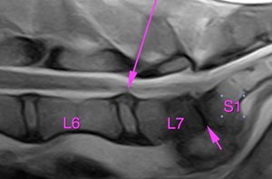 RM d’un chien présentant une dégénérescence discale et une spondylose doulouresue sans déficit nerveux car pas de hernie