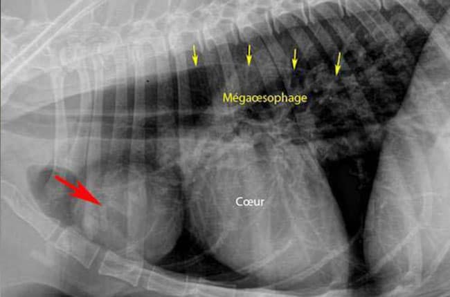 Radiographie du thorax