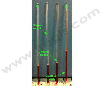 Hématocrite chez le chien. Hémodilution (A) et hémoconcentration (B) du sang
