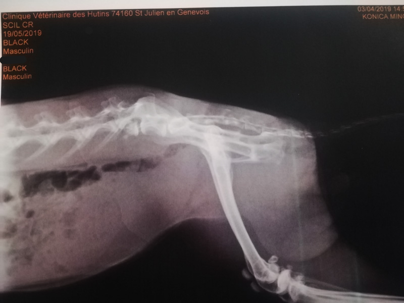 Radio de la colonne montre une fracture vertébrale en L6 avec luxation L6-L7