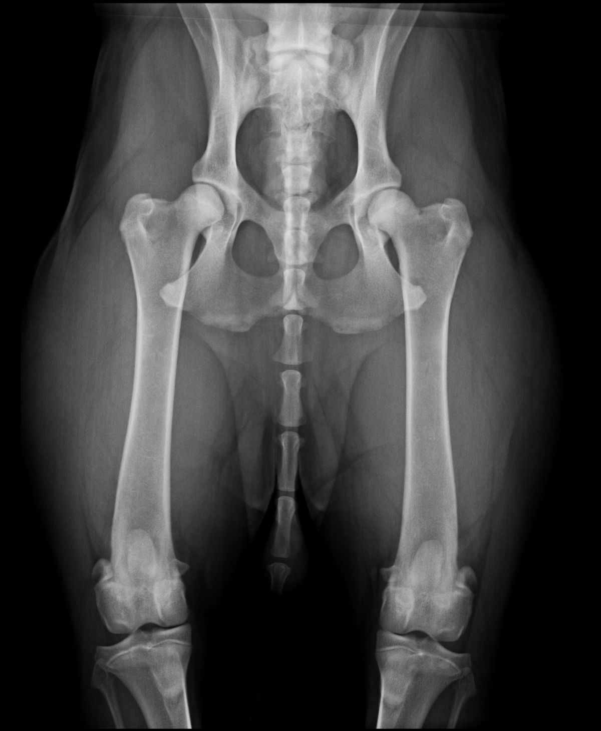 Radiographie de la congruence articulaire satisfaisante