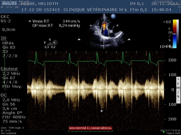 Cardiologie analyse