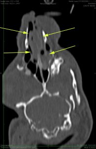 scanner des cavités nasales d’un lapin atteint d’une rhinite chronique