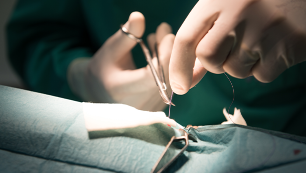 Chirurgie suture