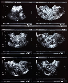 Echographies abdominales et cardiaques à Gap