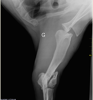 Radiographie pré-opératoire de face