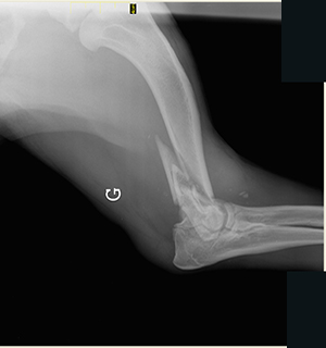 Radiographie pré-opératoire de profil