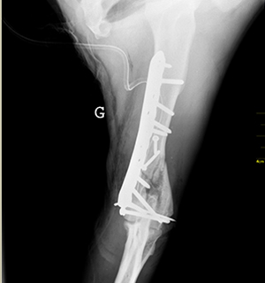 Radiographie post-opératoire de face