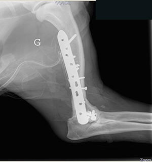 Radiographie post-opératoire de profil