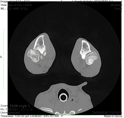 scanner chien