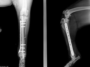 fracture post-op