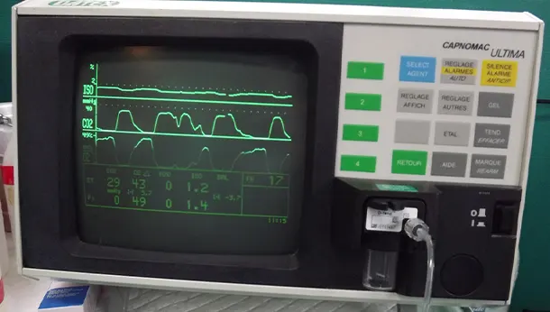 monitoring cardiaque